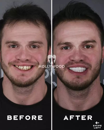 Slider image (1) Hollywood Dental Izmir Turkey